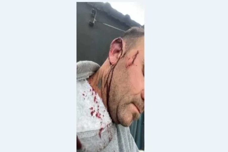 Intendente de Pueblo Brugo Agredido Durante Tensa Discusión en el Concejo Deliberante